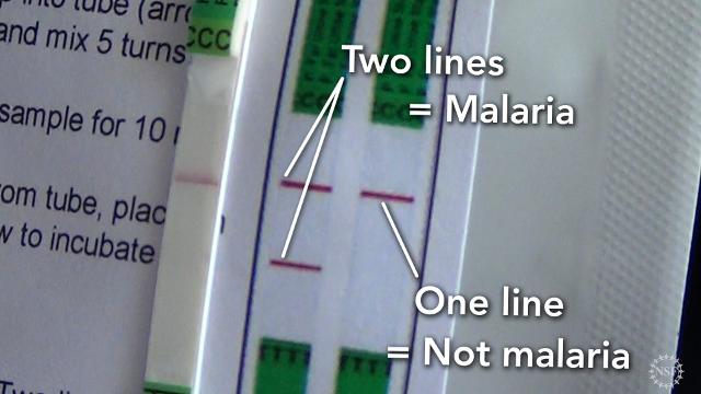 A cheaper, easier way to test for Malaria